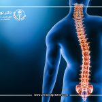 اسکولیوز بزرگسالان: چرا بعد از بلوغ ظاهر می شود؟
