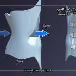 بریس درمانی اسکولیوز: عملکرد و کارایی