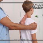 جراحی اسکولیوز در نوجوانان: چه زمانی لازم است؟