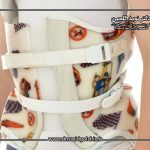 بریس درمانی کودک:چگونه بفهمیم فرزندمان به آن نیاز دارد؟
