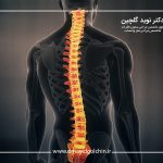 درمان اسکولیوز بدون جراحی: راهنمای جامع برای بیماران در تمام سنین