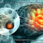 روش های تشخیص تومور مغزی