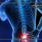 تنگی خفیف نخاعی: آیا باید نگران آینده باشم یا فقط تحت نظر بمانم؟