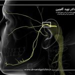 جراحی عصب سه قلو (Trigeminal Neuralgia)؛ آخرین راهکار درمان درد صورت