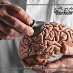 آیا تومور هیپوفیز بر هورمون ها و وزن تأثیر می گذارد؟