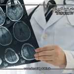 بهترین روش تشخیص آنوریسم مغزی در سال 2025 چیست؟