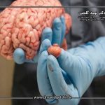 تشخیص تومور هیپوفیز در MRI چگونه انجام می شود؟