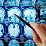 فرق تومور خوش خیم و بدخیم مخچه چیست؟