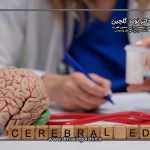 جدیدترین درمان های ادم مغزی در سال 2025 چیست؟