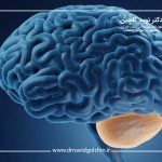 بهترین روش های درمان تومور مخچه در سال 2025 چیست؟