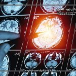 مننژیوم مغزی دقیقا چیست و چرا ایجاد می شود؟