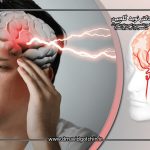 آیا پارگی آنوریسم مغزی بدون علامت قبلی هم ممکن است؟