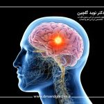 تومور مغزی همیشه با سردرد شدید شروع می‌شود؟ واقعیت‌ها و علائم پنهان